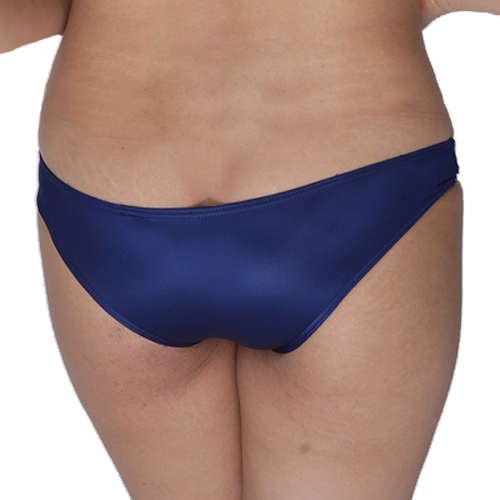 ����X�g���b�`�X�[�p�[���[���C�Y�u���} �R�X�v�� �X�N�[���R�X�`���[�� ���f�B�[�X TW470